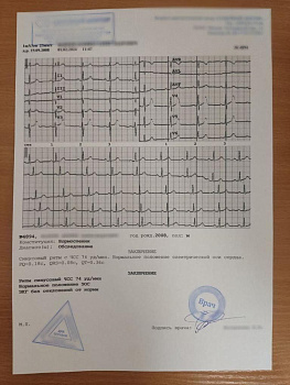 Купить заключение ЭКГ в Москве.